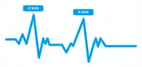 Heartbeat: как мы создали систему управления системой вместо обычных сигналов