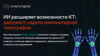 ИИ расширяет возможности компьютерной томографии: дайджест недели Smart Tomo Engine